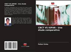 Bookcover of CBCT VS IOPAR - Une étude comparative