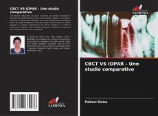 Buchcover von CBCT VS IOPAR - Uno studio comparativo
