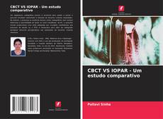 Bookcover of CBCT VS IOPAR - Um estudo comparativo