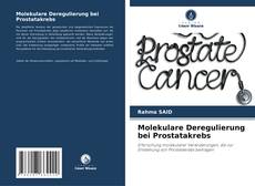 Buchcover von Molekulare Deregulierung bei Prostatakrebs