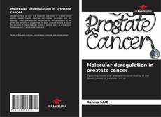 Molecular deregulation in prostate cancer kitap kapağı