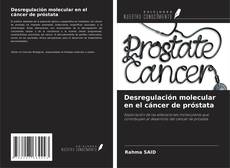 Portada del libro de Desregulación molecular en el cáncer de próstata
