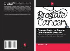 Bookcover of Desregulação molecular no cancro da próstata