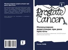 Обложка Молекулярная дерегуляция при раке простаты