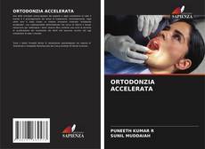 Bookcover of ORTODONZIA ACCELERATA