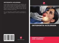 Bookcover of ORTODONTIA ACELERADA
