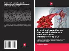 Capa do livro de Proteína C -reactiva de alta sensibilidade: um novo marcador inflamatório de DCV 
