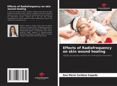 Bookcover of Effects of Radiofrequency on skin wound healing