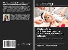 Couverture de Efectos de la radiofrecuencia en la cicatrización de heridas cutáneas