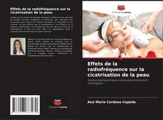 Bookcover of Effets de la radiofréquence sur la cicatrisation de la peau