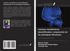 Copertina di Lesiones mandibulares desmitificadas: comprensión de las patologías fibroóseas