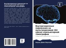 Portada del libro de Внутричерепные поражения на мультисрезовой (64 среза) компьютерной томографии