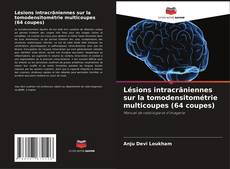 Couverture de Lésions intracrâniennes sur la tomodensitométrie multicoupes (64 coupes)