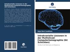 Bookcover of Intrakranielle Läsionen in der Multisliced-Computertomographie (64 Schichten)