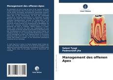 Management des offenen Apex kitap kapağı