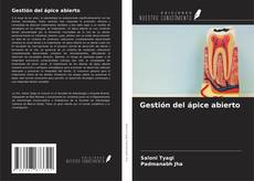 Buchcover von Gestión del ápice abierto
