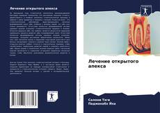 Portada del libro de Лечение открытого апекса