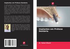 Implantes em Prótese Dentária kitap kapağı