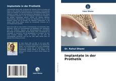 Bookcover of Implantate in der Prothetik