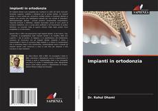 Bookcover of Impianti in ortodonzia