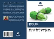 Bookcover of Alternative Behandlung des oralen Lichen planus
