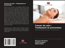 Copertina di Cancer du sein : Traitement et prévention