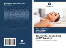 Bookcover of Brustkrebs: Behandlung und Prävention