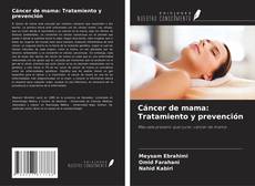 Buchcover von Cáncer de mama: Tratamiento y prevención