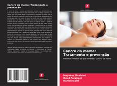 Bookcover of Cancro da mama: Tratamento e prevenção