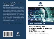 Bookcover of Untersuchung der Expression von TGF-α und EGFR bei Schilddrüsenkrebs