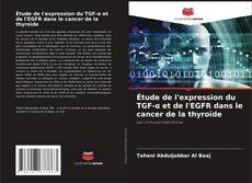 Capa do livro de Étude de l'expression du TGF-α et de l'EGFR dans le cancer de la thyroïde 