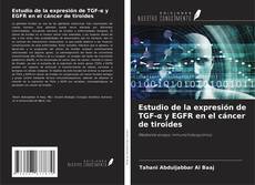 Buchcover von Estudio de la expresión de TGF-α y EGFR en el cáncer de tiroides