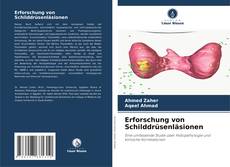 Erforschung von Schilddrüsenläsionen kitap kapağı