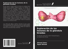 Bookcover of Exploración de las lesiones de la glándula tiroides