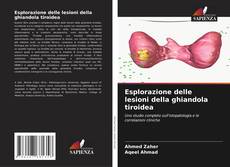 Bookcover of Esplorazione delle lesioni della ghiandola tiroidea