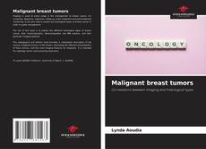 Couverture de Malignant breast tumors