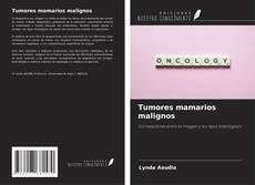 Bookcover of Tumores mamarios malignos