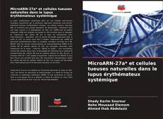 Copertina di MicroARN-27a* et cellules tueuses naturelles dans le lupus érythémateux systémique