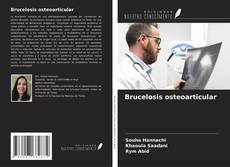 Bookcover of Brucelosis osteoarticular