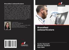 Capa do livro de Brucellosi osteoarticolare 