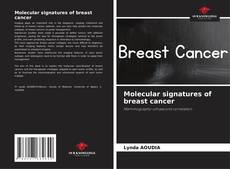 Borítókép a  Molecular signatures of breast cancer - hoz