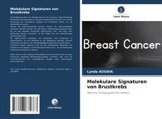 Bookcover of Molekulare Signaturen von Brustkrebs