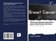 Bookcover of Молекулярные признаки рака молочной железы