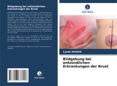 Обложка Bildgebung bei entzündlichen Erkrankungen der Brust