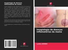 Imagiologia de doenças inflamatórias da mama的封面