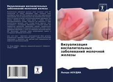 Bookcover of Визуализация воспалительных заболеваний молочной железы