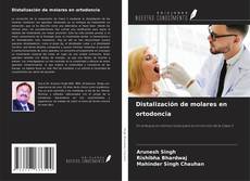 Buchcover von Distalización de molares en ortodoncia