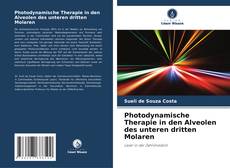Copertina di Photodynamische Therapie in den Alveolen des unteren dritten Molaren