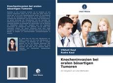 Bookcover of Knocheninvasion bei oralen bösartigen Tumoren