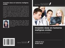 Buchcover von Invasión ósea en tumores malignos orales